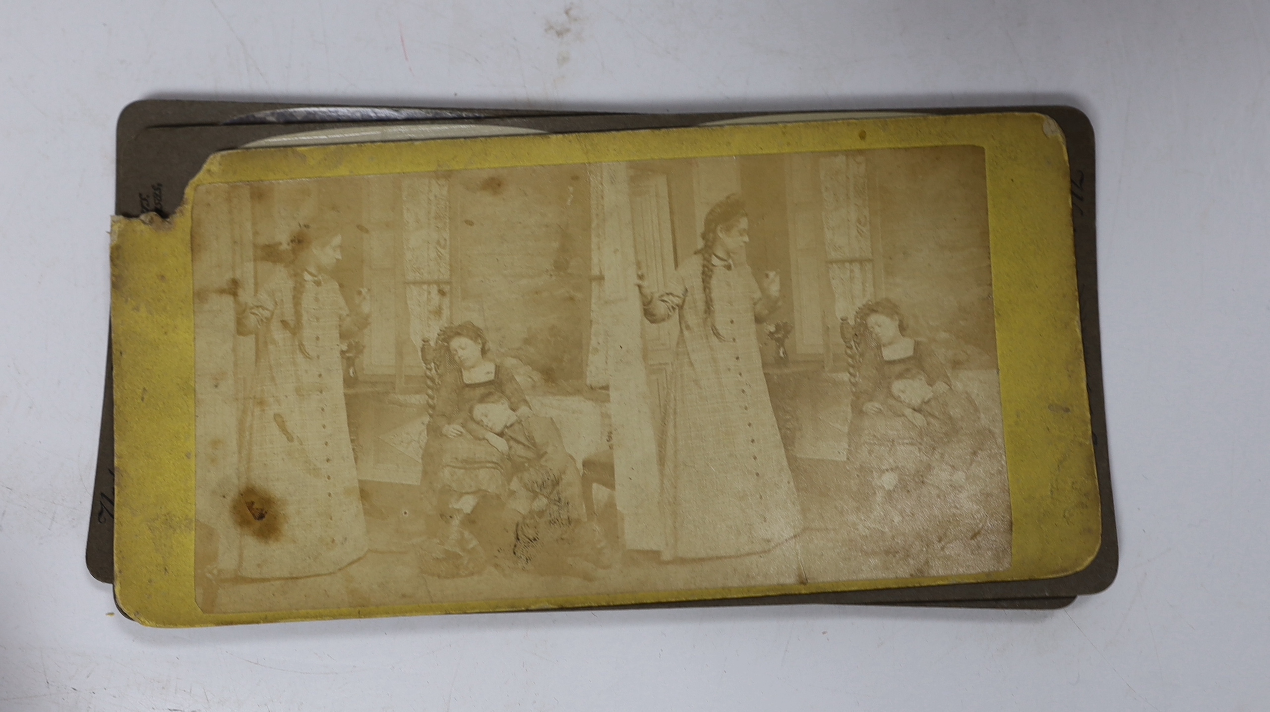 Stereoscopic cards from a set by The Edinburgh Stereoscopic Atlas of Anatomy with detailed information above the photographs, together with a small number of additional cards of different subjects